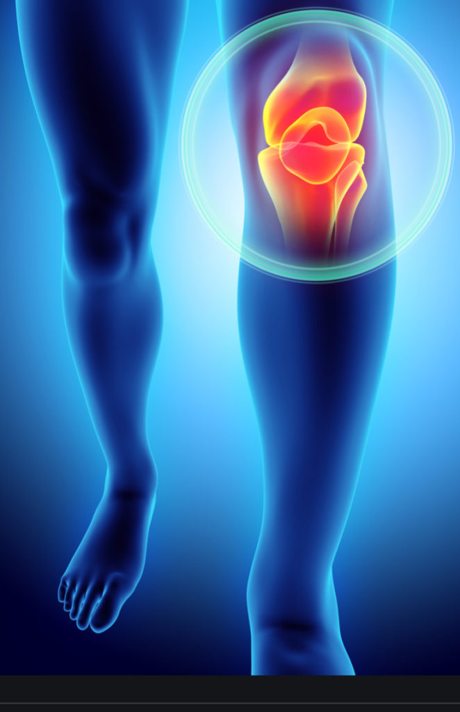 How effective is Physical Therapy on knee pain? CORE Omaha tells you ...