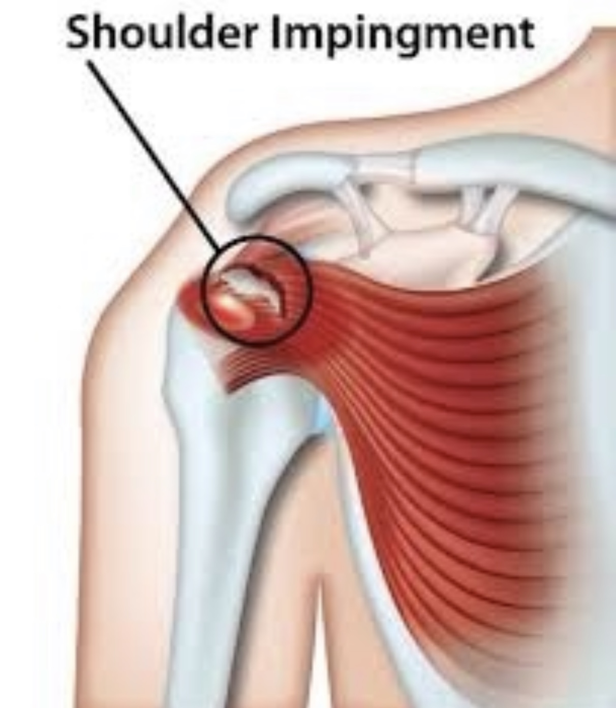 Shoulder Pain Relief - Tips from Ottawa, Orleans Chiropractor