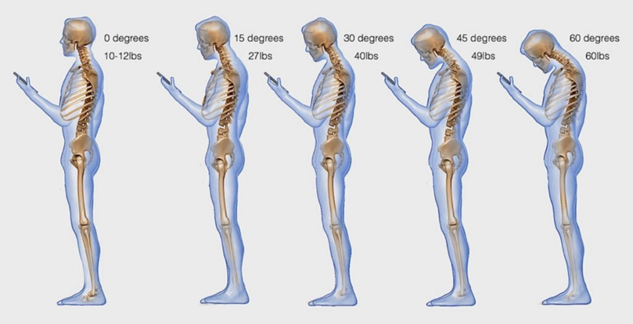 Do You Have Good Posture?  APC Physiotherapy and Sports Clinic